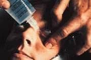 Figure 12. Irrigation. Using bottle of normal saline to irrigate the eye, patient is instructed to look in various directions while the opposite portions of the conjunctival cul-de-sac are flushed vigorously. Photo credit: 2018 American Academy of Ophthalmology.