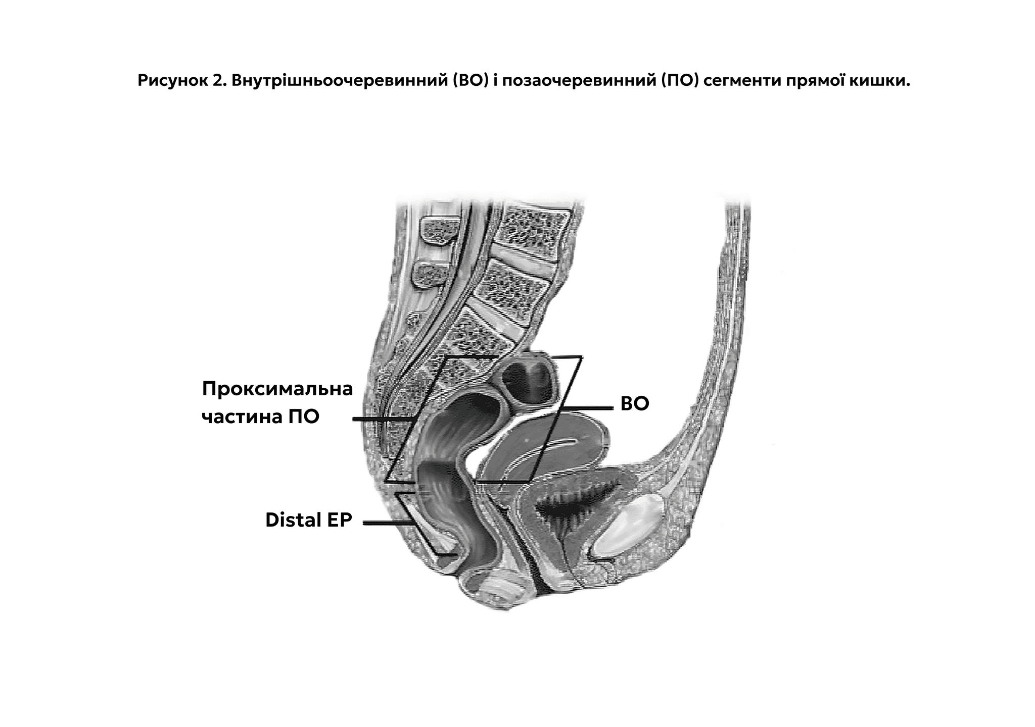 Figure_1_Rectal.png